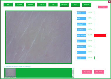 Professional Video Dermatoscope Analysis System With Analysis And Testing Report