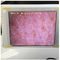 White Wifi Skin Moisture Checker Skin Moisture Sensor With Photo Displaying In Ipad